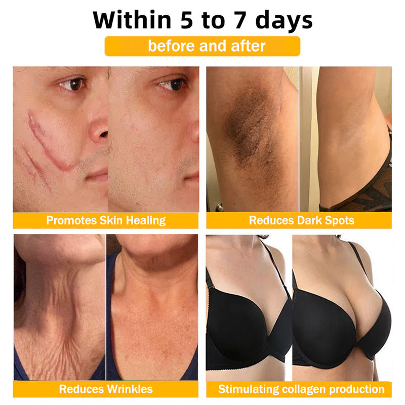 Congratulations on getting 50% discount! Only the last 5 left in stock! Our products are TGA&FDA approved! Complete transformation with in 3 weeks!