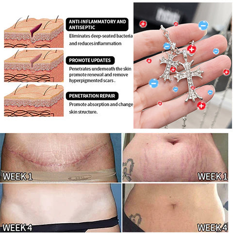 Congratulations on getting 50% discount! Only the last 5 left in stock! Our products are TGA&FDA approved! Complete transformation with in 3 weeks!