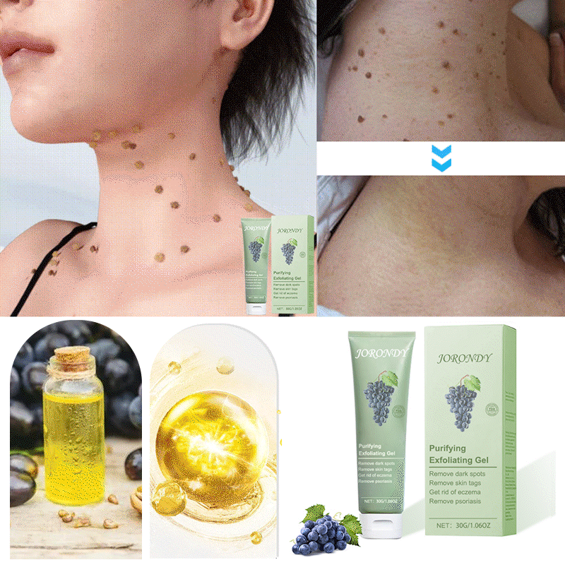 Cabernet Sauvignon Extract Purifying Exfoliating Gel🍇-For Acanthosis Nigricans, Exfoliation, Dark Spots, Skin Tags, and Eczema