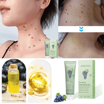 Cabernet Sauvignon Extract Purifying Exfoliating Gel🍇-For Acanthosis Nigricans, Exfoliation, Dark Spots, Skin Tags, and Eczema