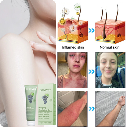 Cabernet Sauvignon Extract Purifying Exfoliating Gel🍇-For Acanthosis Nigricans, Exfoliation, Dark Spots, Skin Tags, and Eczema