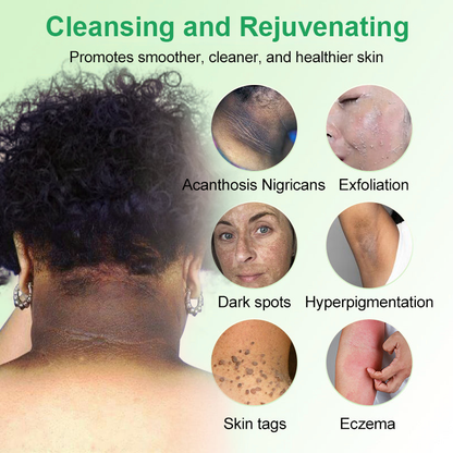Cabernet Sauvignon Extract Purifying Exfoliating Gel🍇-For Acanthosis Nigricans, Exfoliation, Dark Spots, Skin Tags, and Eczema