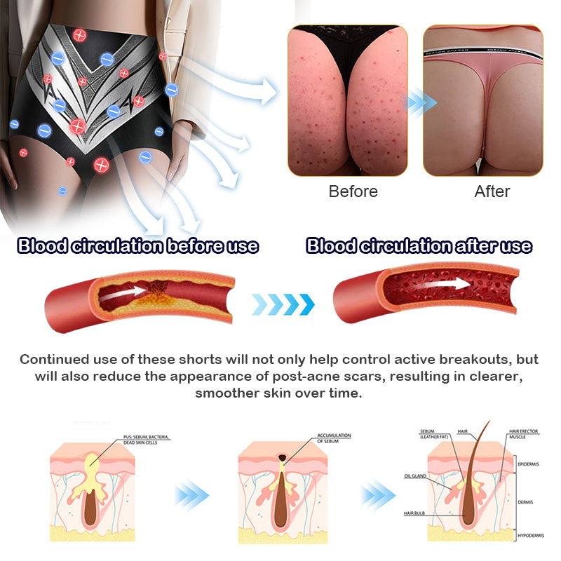 Medical Grade Titanium Fiber Tourmaline Shaping Shorts👩🏻‍⚕️ (LAST DAY SALE-80% OFF)