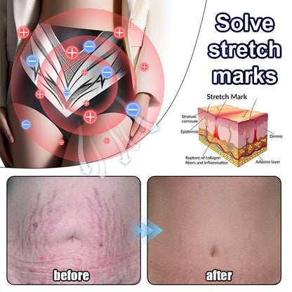 Medical Grade Titanium Fiber Tourmaline Shaping Shorts👩🏻‍⚕️ (LAST DAY SALE-80% OFF)
