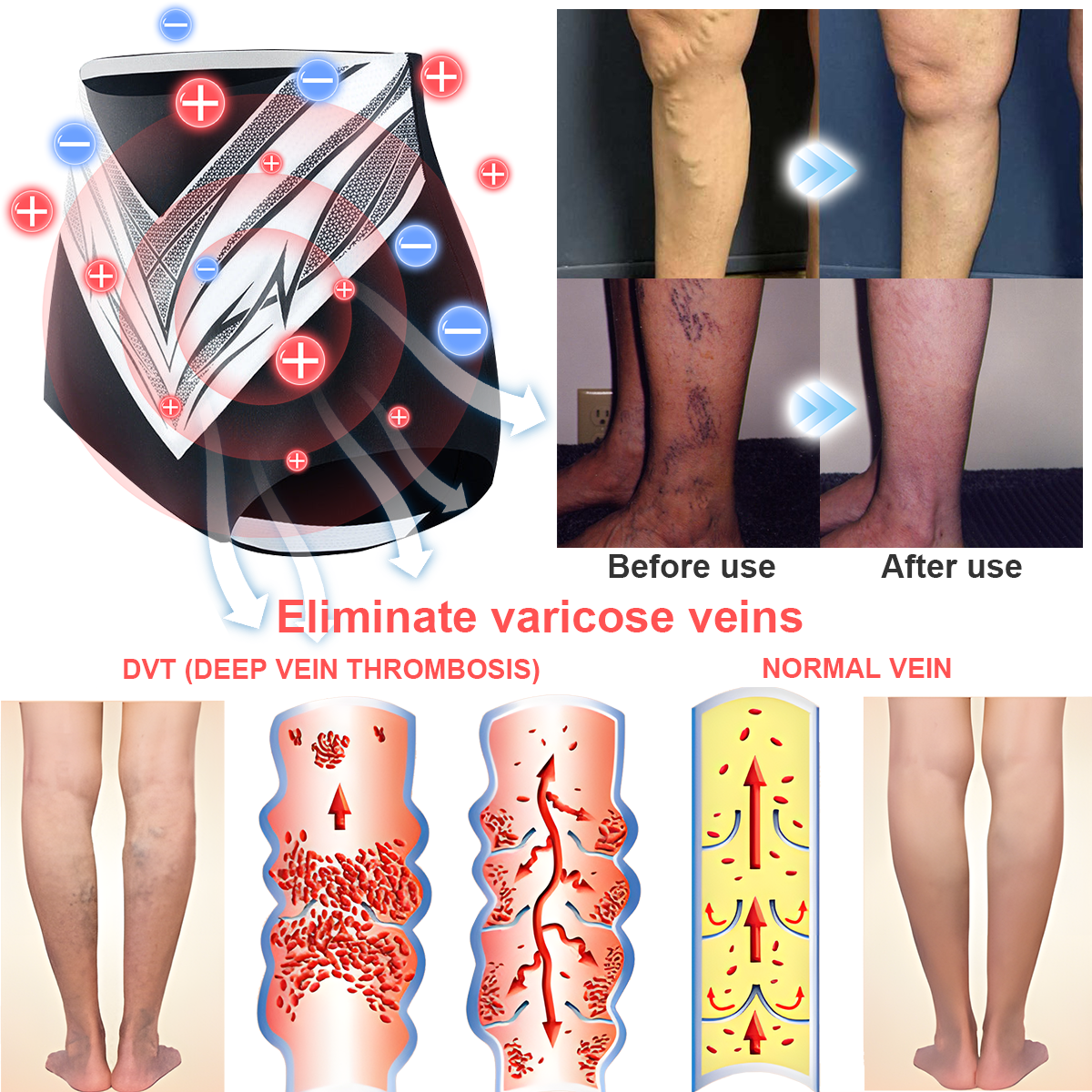Medical Grade Titanium Fiber Tourmaline Shaping Shorts👩🏻‍⚕️ (LAST DAY SALE-80% OFF)