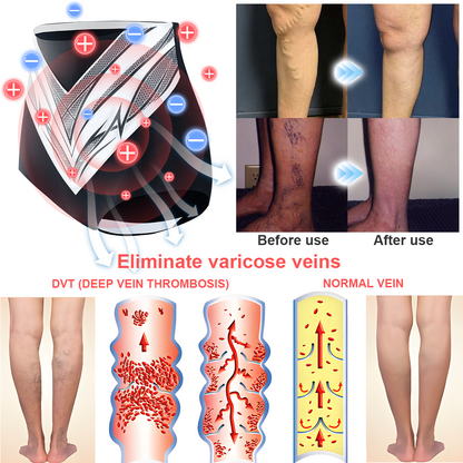 Medical Grade Titanium Fiber Tourmaline Shaping Shorts👩🏻‍⚕️ (LAST DAY SALE-80% OFF)